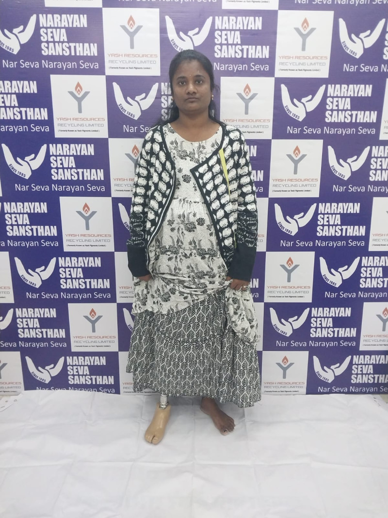 Narayan Seva Sansthan and Yash Resources Recycling Limited, Hyderabad Restore Mobility to 100 Persons with Disabilities through CSR Initiative decoding=