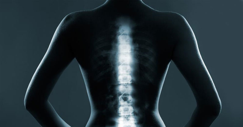 Complex Spinal Surgeries has now become much easier with latest surgical device decoding=