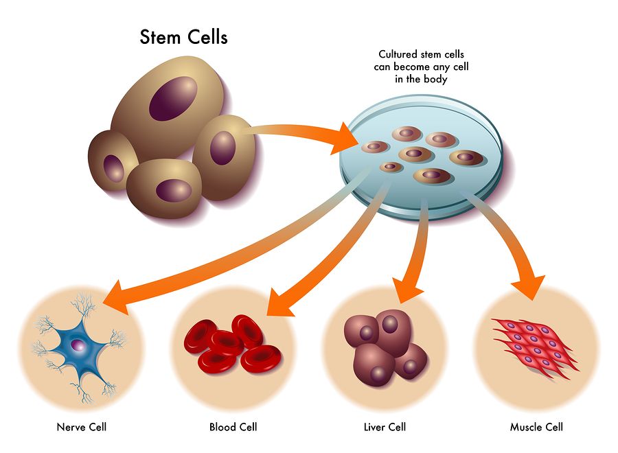 22-year-old Bangladeshi boy suffering from avascular necrosis treated with advanced stem cell regenerative technique decoding=