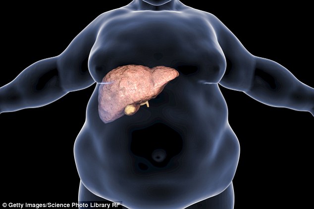 Fatty liver disease due to obesity hits youngsters now decoding=