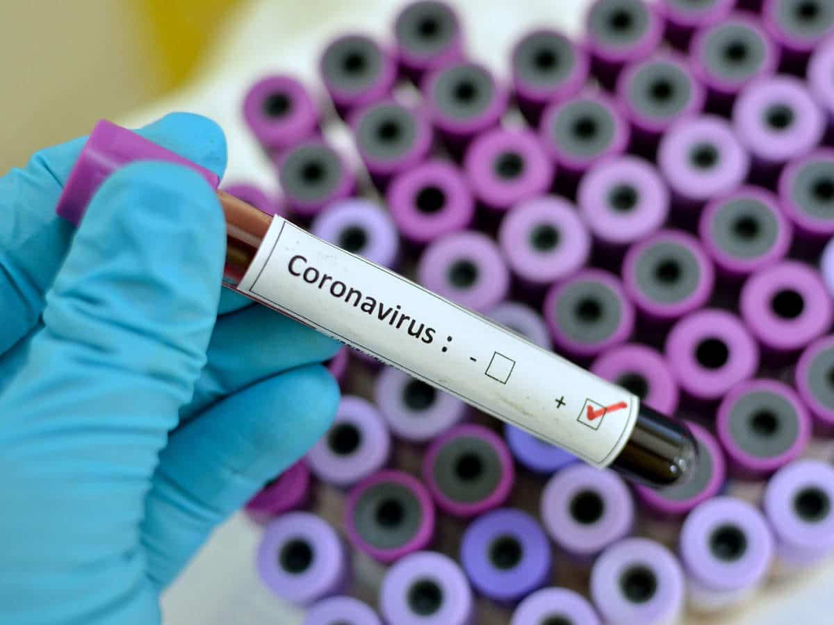 over-14-27-lakh-people-recovered-from-coronavirus-infection-in-the-country