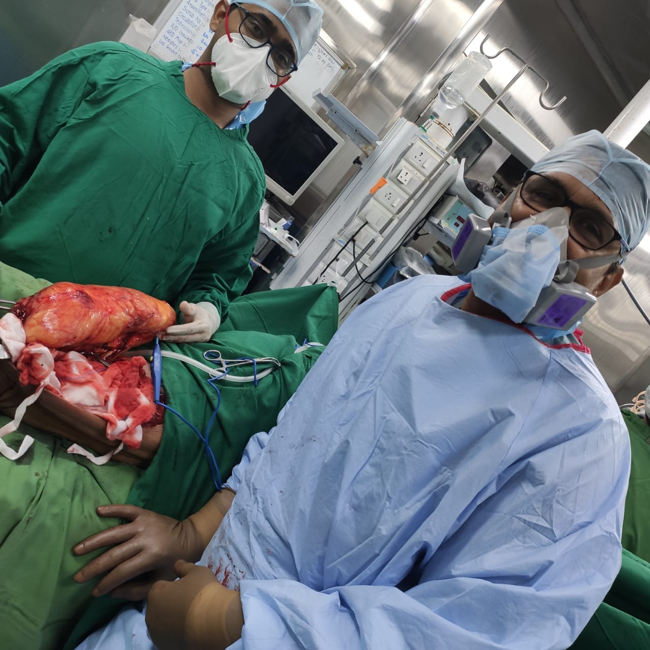 four-kg-tumor-successfully-removed-from-a-64-year-old-mans-leg