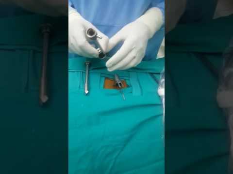 Satnam device for endoscopic surgeries to treat spinal problems decoding=