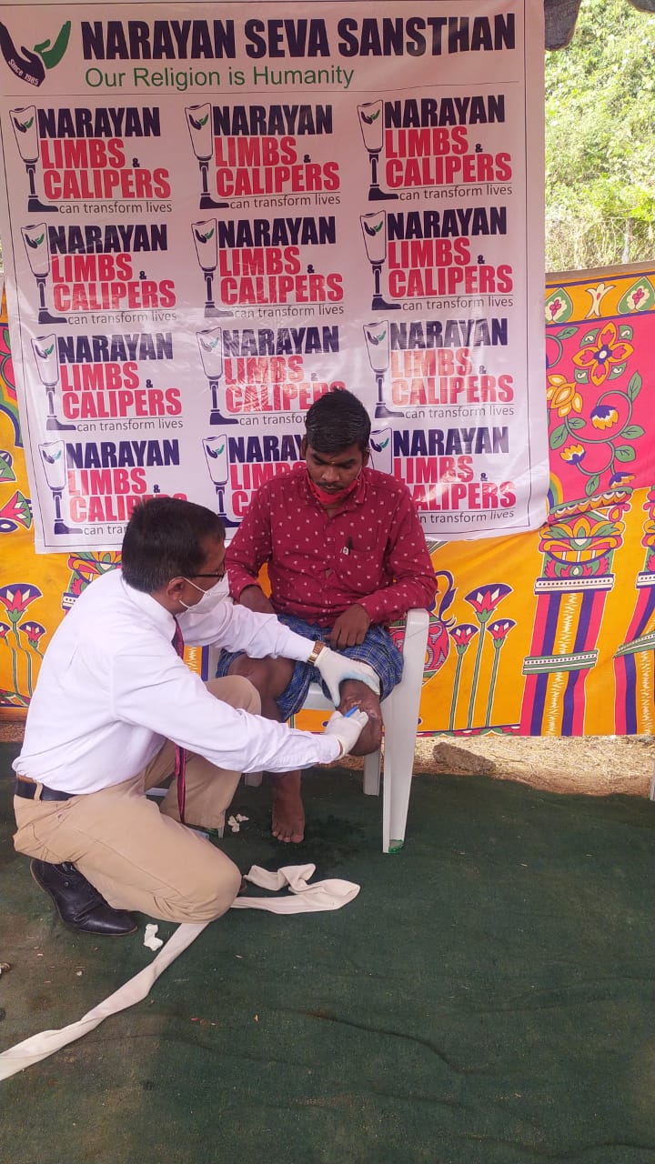 NSS organized free artificial limb camp in Hyderabad – pledges to perform this across India decoding=